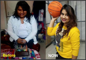 Young lady weight loss transformation